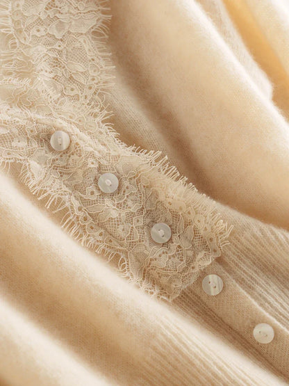 | Lace Cardigan